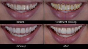 دکتر امید مسجدی -جراح و دندانپزشک اصلاح خط لبخند و زیبایی