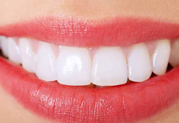 نمونه دندان سالم